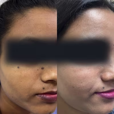 Chronic skin condition care